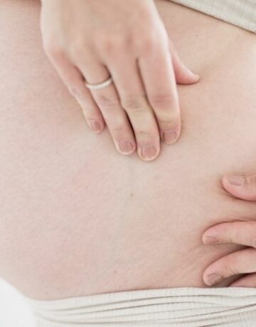 Woman strokes and massages belly against stretch marks
