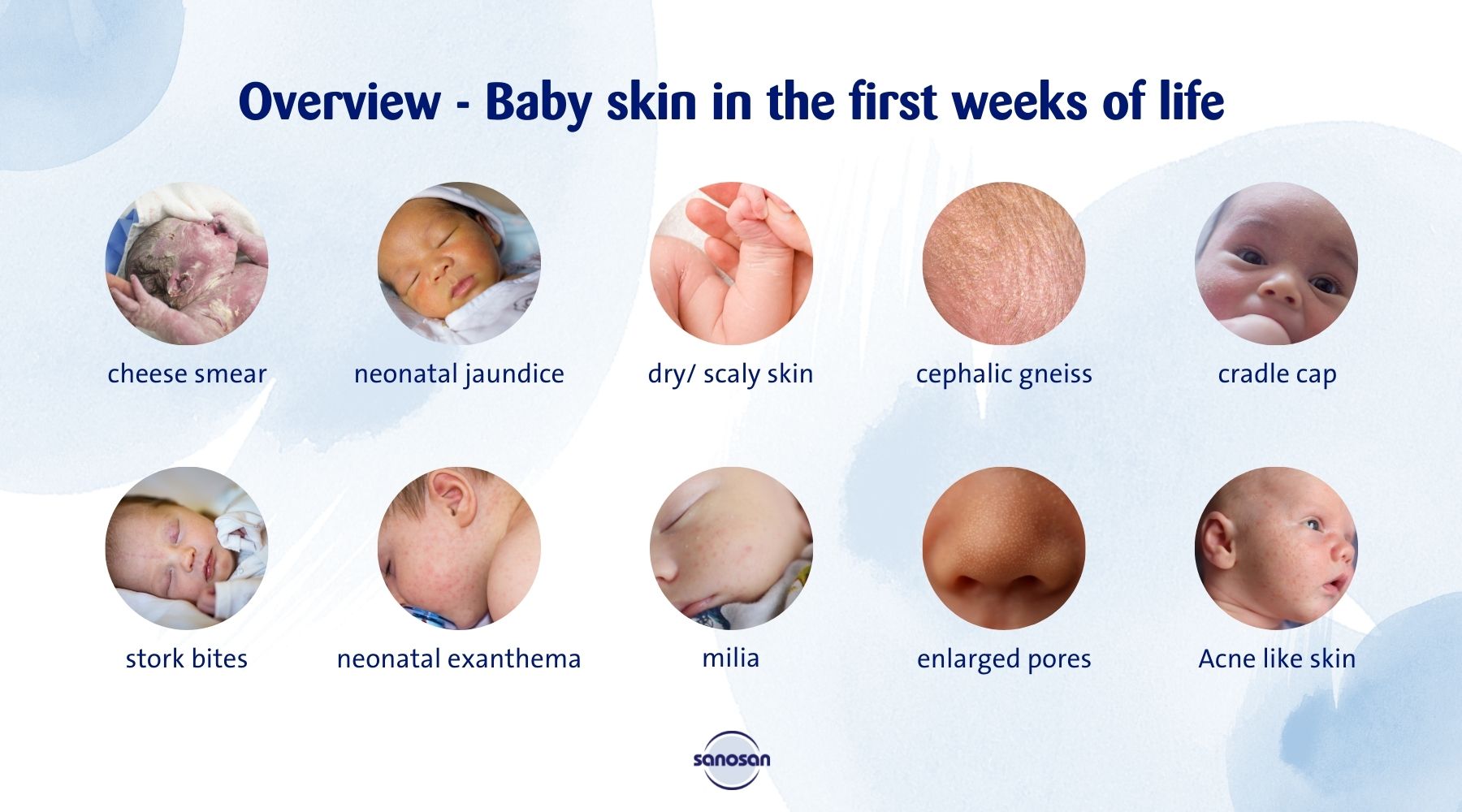 Overview - Baby skin in the first weeks of life infographic