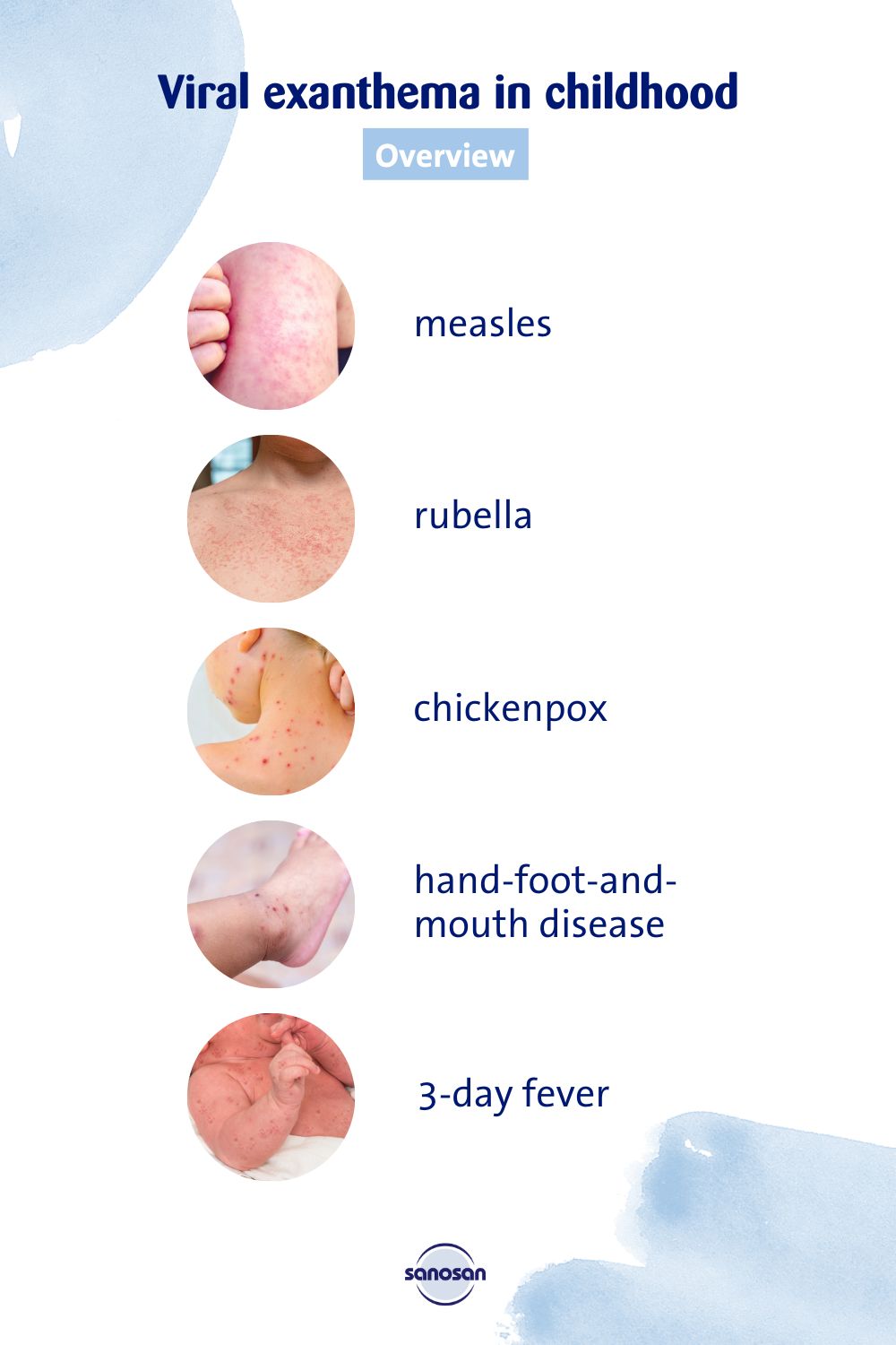 Viral Exanthema In Childhood - Sanosan