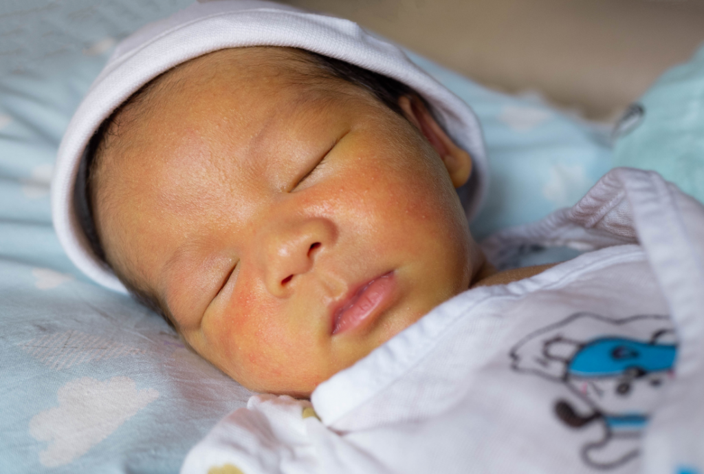 baby-skin-first-weeks-of-life-neonatal-jaundice